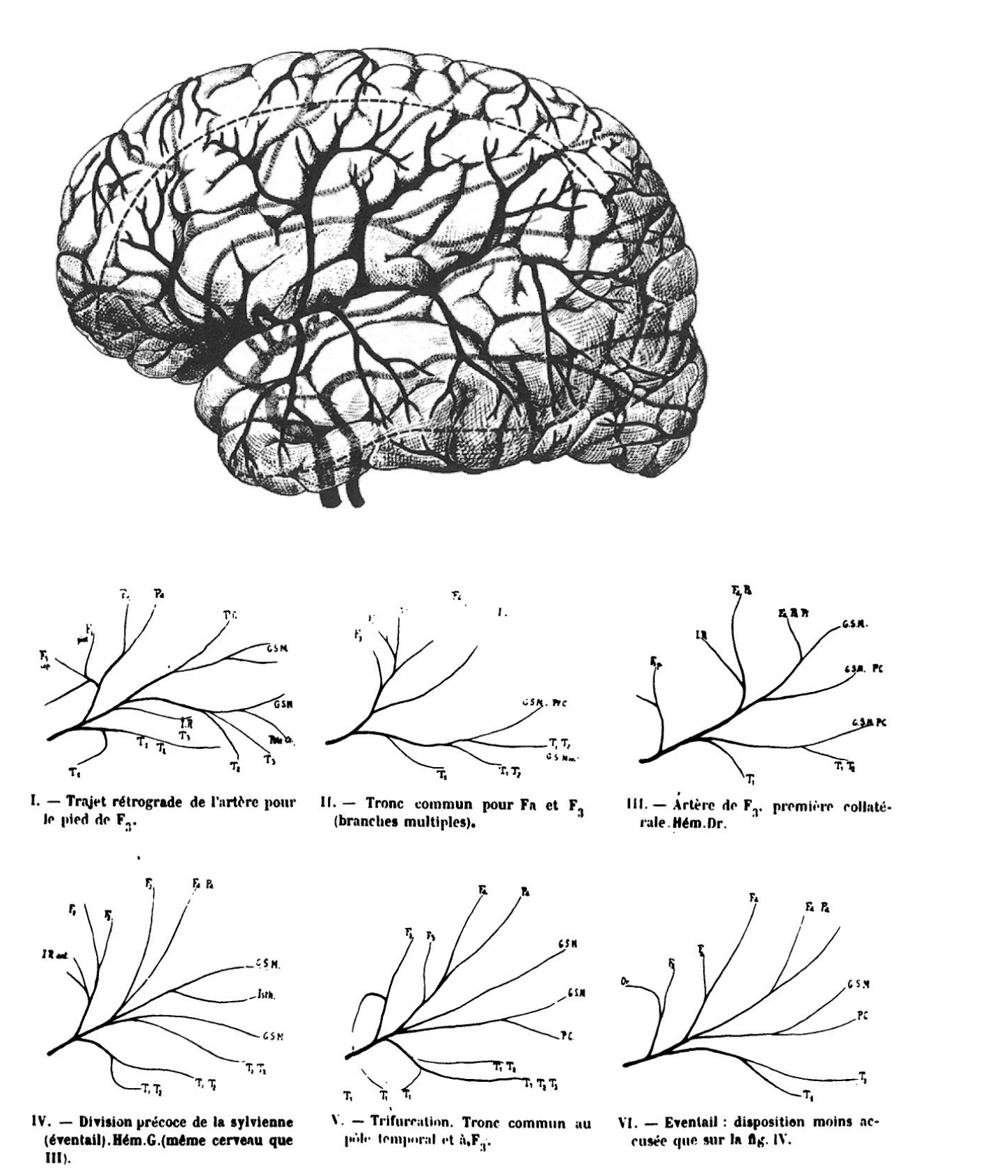 Vascular anatomy of the perisylvian space — MCA territory and six branching variants
